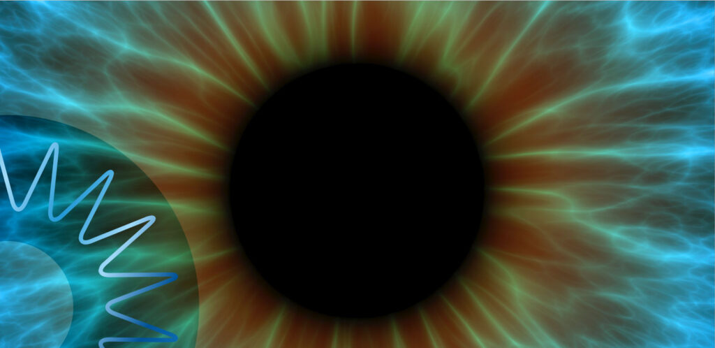 VEOnet Eye image