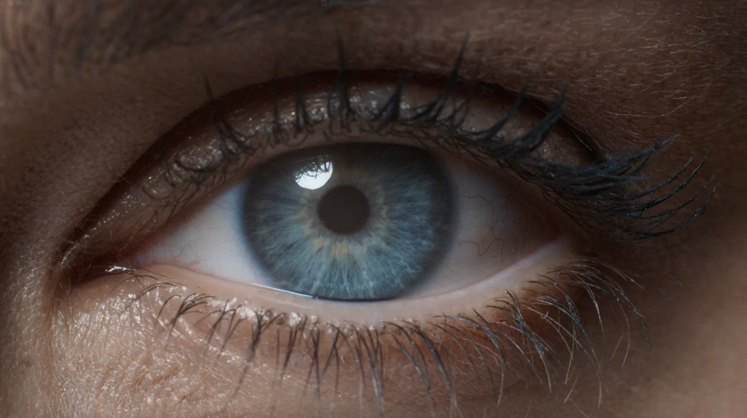 Dropless Cataract Surgery ┃ SpaMedica